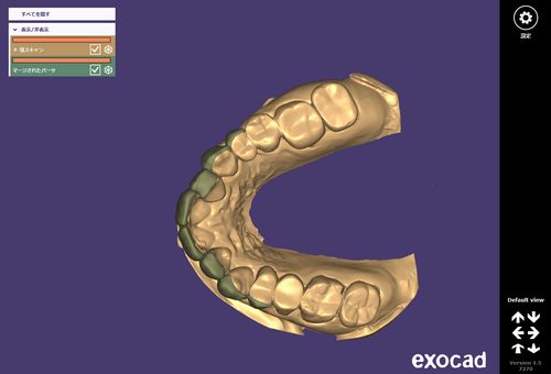 ※画像をクリックすると歯科用CADデータのサンプルがご覧いただけます。